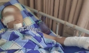 17岁准大学生外出旅游在酒店遭砍伤！警方通报
