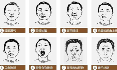 男孩戴风扇睡觉被吹面瘫，夏天可不能这么造！