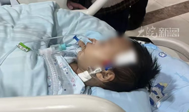 1岁8个月男童春节探亲鼠药中毒，至今在ICU昏迷未醒，靠呼吸机维持生命，爸爸：他还没好好看过这个世界