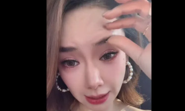 知名女演员承认过度医美，大方回应“吊梢眼”：整个眉毛完全动不了……